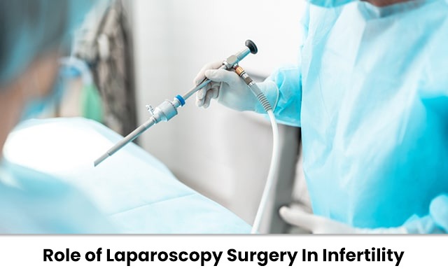laparoscopic surgery for infertility in Kolkata